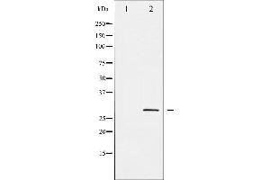 Western blot analysis of SNAI1 phosphorylation expression in HT29 whole cell lysates,The lane on the left is treated with the antigen-specific peptide. (SNAIL Antikörper  (pSer246))