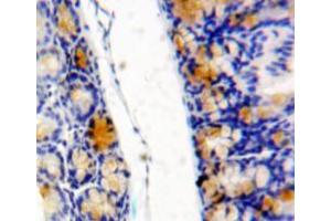 Used in DAB staining on fromalin fixed paraffin-embedded bowels tissue (eIF4EBP1 Antikörper  (AA 2-117))