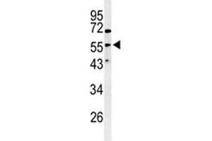 Western blot analysis of Vimentinin antibody and HeLa lysate