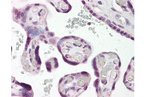 Anti-DLX3 antibody IHC of human placenta.