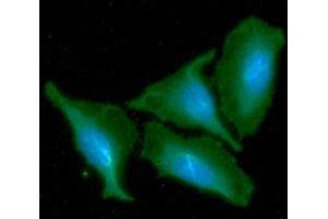 ICC/IF analysis of CKMT1A in HeLa cells line, stained with DAPI (Blue) for nucleus staining and monoclonal anti-human CKMT1A antibody (1:100) with goat anti-mouse IgG-Alexa fluor 488 conjugate (Green).