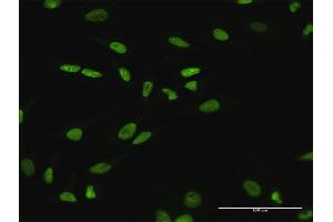 Immunofluorescence of purified MaxPab antibody to SATB1 on HeLa cell. (SATB1 Antikörper  (AA 1-763))