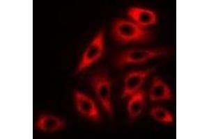 Immunofluorescent analysis of RPLP0 staining in K562 cells. (RPLP0 Antikörper)