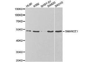 Western Blotting (WB) image for anti-SWI/SNF Related, Matrix Associated, Actin Dependent Regulator of Chromatin, Subfamily E, Member 1 (SMARCE1) antibody (ABIN1876549) (SMARCE1 Antikörper)