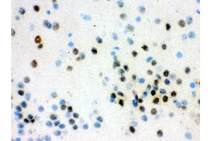 Immunohistochemistry (IHC) image for anti-Valosin Containing Protein (VCP) (AA 732-760), (C-Term) antibody (ABIN3043958)
