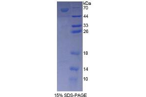 SDS-PAGE analysis of Rat ANKRD1 Protein. (ANKRD1 Protein)