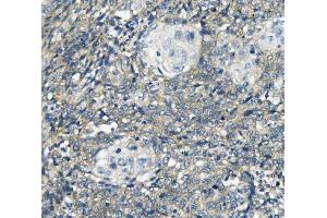 IHC analysis of PHEX using anti-PHEX antibody (ABIN7600072). (PHEX Antikörper  (AA 145-718))