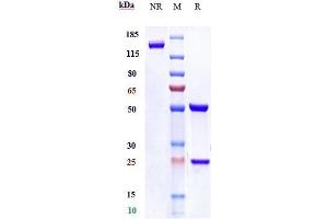 Anti- Human LAG3( Relatlimab) on SDS-PAGE under reducing (R) condition. (Rekombinanter LAG3 (Relatlimab Biosimilar) Antikörper)