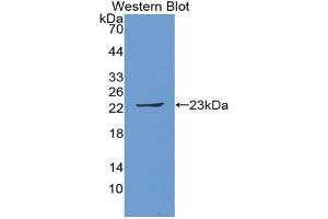 Western blot analysis of the recombinant protein. (FTH1 Antikörper  (AA 1-182))