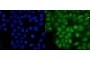 IF analysis of PSMB5/MB1 using anti-PSMB5/MB1 antibody (ABIN7599183).