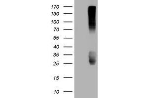 Image no. 3 for anti-CD99 (CD99) antibody (ABIN1497384) (CD99 Antikörper)