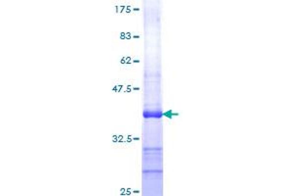 CYR61 Protein (AA 293-381) (GST tag)
