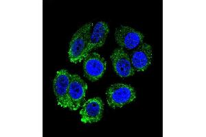 Confocal immunofluorescent analysis of RARS Antibody (C-term) (ABIN655043 and ABIN2844674) with MCF-7 cell followed by Alexa Fluor 488-conjugated goat anti-rabbit lgG (green). (RARS Antikörper  (C-Term))