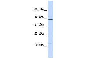 WB Suggested Anti-SPINK1 Antibody Titration:  0. (SPINK1 Antikörper  (N-Term))