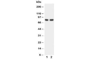 Western blot testing of FOXP1 antibody and Lane 1:  rat spleen (FOXP1 Antikörper  (C-Term))