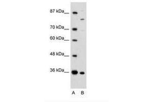 Image no. 1 for anti-Ankyrin Repeat and Zinc Finger Domain Containing 1 (ANKZF1) (AA 106-155) antibody (ABIN6735962) (ANKZF1 Antikörper  (AA 106-155))