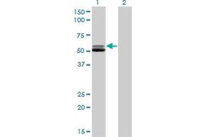 Western Blotting (WB) image for anti-Glutathione Reductase (GSR) (AA 413-523) antibody (ABIN598715) (Glutathione Reductase Antikörper  (AA 413-523))