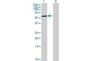 Western Blot analysis of LPCAT4 expression in transfected 293T cell line by LPCAT4 MaxPab polyclonal antibody. (LPCAT4 Antikörper  (AA 1-524))