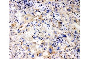 IHC analysis of APOL1 using anti-APOL1 antibody (ABIN7600725). (APOL1 Antikörper  (AA 228-398))