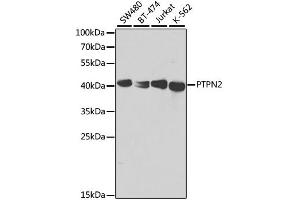 Western blot analysis of extracts of various cell lines, using PTPN2 antibody. (PTPN2 Antikörper)