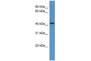 Western Blotting (WB) image for anti-UDP-Gal:betaGlcNAc beta 1,4- Galactosyltransferase, Polypeptide 5 (B4GALT5) (C-Term) antibody (ABIN2773883)