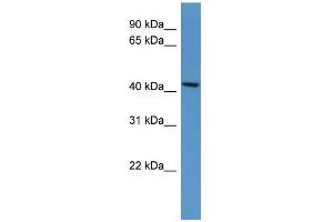WB Suggested Anti-B4galt5 Antibody Titration: 0. (B4GALT5 Antikörper  (C-Term))