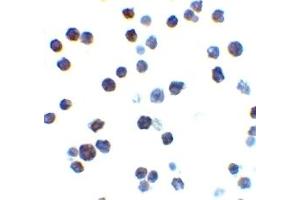 Immunohistochemistry (IHC) image for anti-BCL2-Antagonist/killer 1 (BAK1) (N-Term) antibody (ABIN1031258) (BAK1 Antikörper  (N-Term))