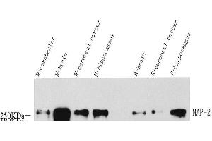 Western Blot analysis of various samples using MAP2 Polyclonal Antibody at dilution of 1:1000. (MAP2 Antikörper)