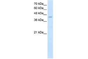 WB Suggested Anti-FADS1 Antibody Titration:  2. (FADS1 Antikörper  (C-Term))