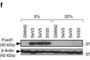 MICU1 is transcriptionally regulated by Foxd1 under hypoxia. (FOXD1 Antikörper  (C-Term))
