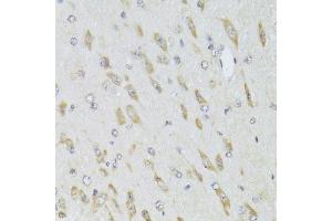 Immunohistochemistry of paraffin-embedded mouse brain using RPL13 Antibody. (RPL13 Antikörper  (AA 1-211))