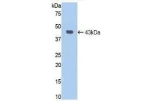 Detection of Recombinant JAG1, Human using Polyclonal Antibody to Jagged 1 (JAG1) (JAG1 Antikörper  (AA 470-834))