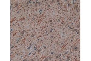 Used in DAB staining on fromalin fixed paraffin- embedded Kidney tissue (PITPNB Antikörper  (AA 2-271))