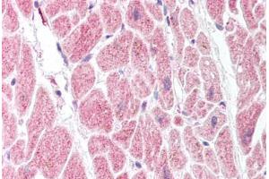 Human Heart (formalin-fixed, paraffin-embedded) stained with PTGIS antibody ABIN214080 at 20 ug/ml followed by biotinylated goat anti-rabbit IgG secondary antibody ABIN481713, alkaline phosphatase-streptavidin and chromogen. (PTGIS Antikörper  (AA 475-490))