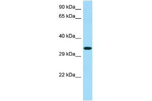 WB Suggested Anti-RBFA Antibody Titration: 1. (RBFA Antikörper  (C-Term))