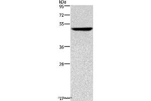 Western blot analysis of Hela cell, using KRT16 Polyclonal Antibody at dilution of 1:350 (KRT16 Antikörper)