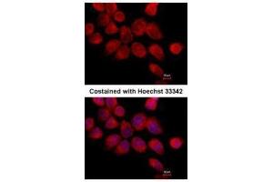ICC/IF Image Immunofluorescence analysis of paraformaldehyde-fixed A431, using Transketolase, antibody at 1:500 dilution. (TKT Antikörper)