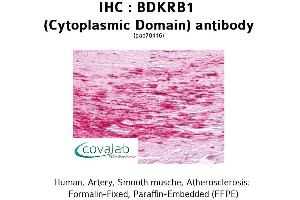 Image no. 1 for anti-Bradykinin Receptor B1 (BDKRB1) (1st Cytoplasmic Domain) antibody (ABIN1732268) (BDKRB1 Antikörper  (1st Cytoplasmic Domain))