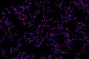 Immunofluorescent analysis of paraformaldehyde-fixed mouse lung using,RPAP2 (ABIN7075481) at dilution of 1: 1000 (RPAP2 Antikörper)