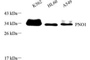 Western blot analysis of PNO1 (ABIN7074991),at dilution of 1: 1000 (PNO1 Antikörper)