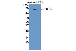 Western blot analysis of the recombinant protein. (EPRS Antikörper  (AA 1007-1512))