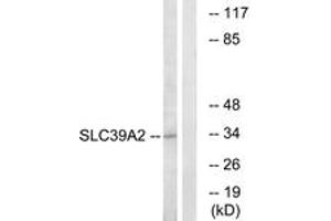 Western Blotting (WB) image for anti-Solute Carrier Family 39 (Zinc Transporter), Member 2 (Slc39a2) (AA 11-60) antibody (ABIN1535490)