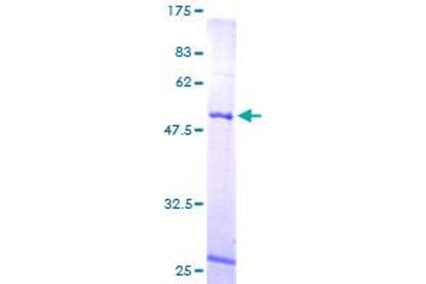 MRPL10 Protein (AA 1-261) (GST tag)