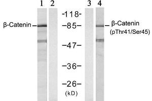 Western blot analysis of extracts from SW626 cell using β-Catenin (Ab-41/45) antibody (E021103, Lane 1 and 2) and β-Catenin (phospho-Thr41/Ser45) antibody (E011116, Lane 3 and 4). (beta Catenin Antikörper)