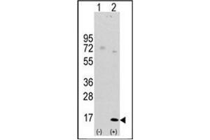 Western blot analysis of LC3 (APG8a) (arrow) using Autophagy LC3 Antibody (APG8a) (D106) Cat. (MAP1LC3A Antikörper  (AA 92-121))