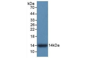 Detection of Recombinant S100A9, Human using Monoclonal Antibody to S100 Calcium Binding Protein A9 (S100A9) (S100A9 Antikörper  (AA 1-114))