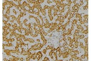 ABIN6276621 at 1/100 staining Mouse liver tissue by IHC-P. (ITPA Antikörper  (Internal Region))