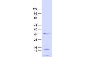 Western Blotting (WB) image for Regulator of G-Protein Signaling 3 (RGS3) protein (His tag) (ABIN2730831)