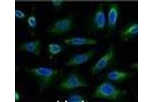 Immunofluorescence analysis of Hela tissue using AQP4 Monoclonal Antibody at dilution of 1:100. (Aquaporin 4 Antikörper)