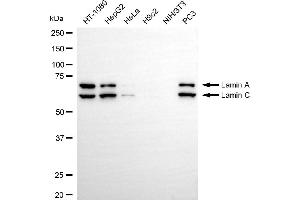 Western blotting analysis using Lamin A/C antibody (ABIN7799228). (Rekombinanter Lamin A/C Antikörper)
